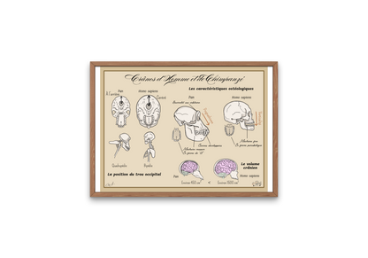 Poster Lignée humaine – Crânes Homme vs Chimpanzé