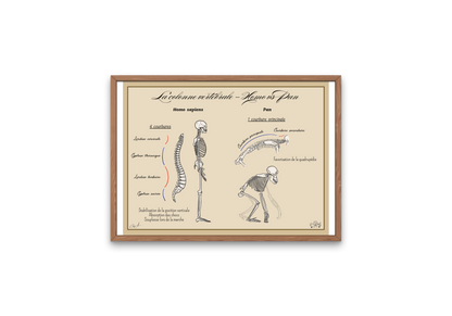 Poster Lignée humaine – Colonne vertébrale Homme vs Chimpanzé
